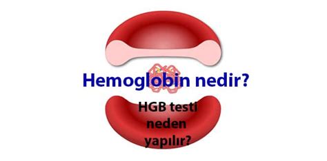 gebelikte hemoglobin düşüklüğü